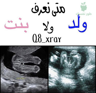طريقة مؤكدة لمعرفة نوع الجنين
